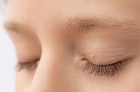 Safely Removing Skin Tags Around the Eyes: A Comprehensive Guide